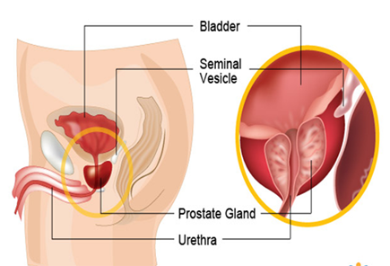 prostate explanation